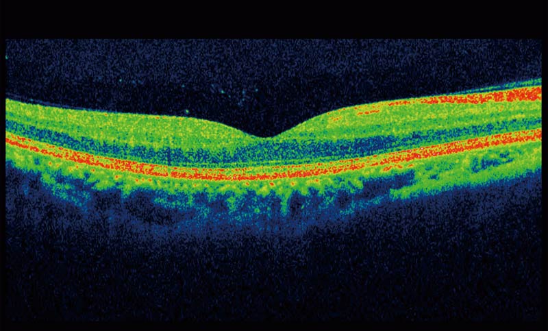 Fiona Jennings Opticians OCT Scan